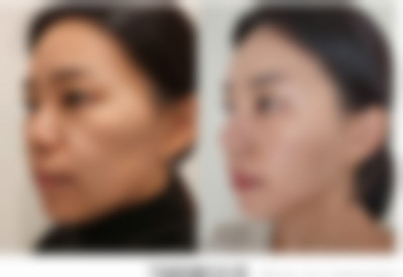 四、湘潭华美整形医院怎么样项目特色