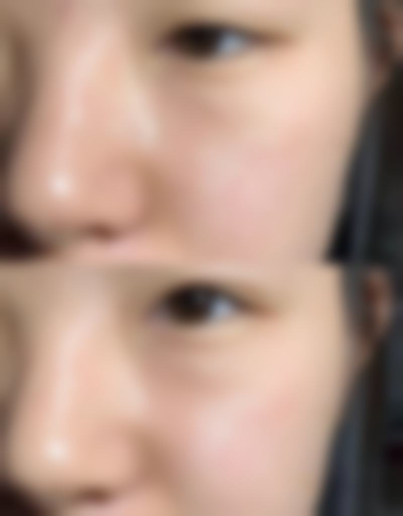 北京玥美医疗美容门诊部价格表