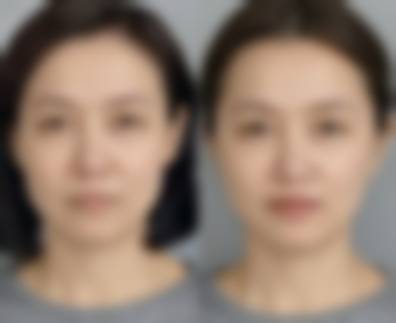 韩国美丽海内外整形外科医院怎么样地址及乘车路线
