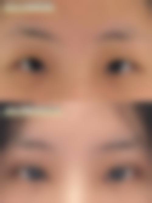 孙衍峰医生顾客实例图片