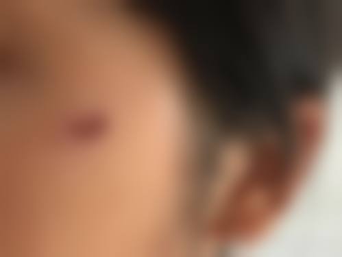 孙衍峰医生项目优势