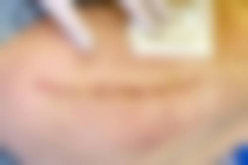 佛山环球美天悦享整形医院项目特色