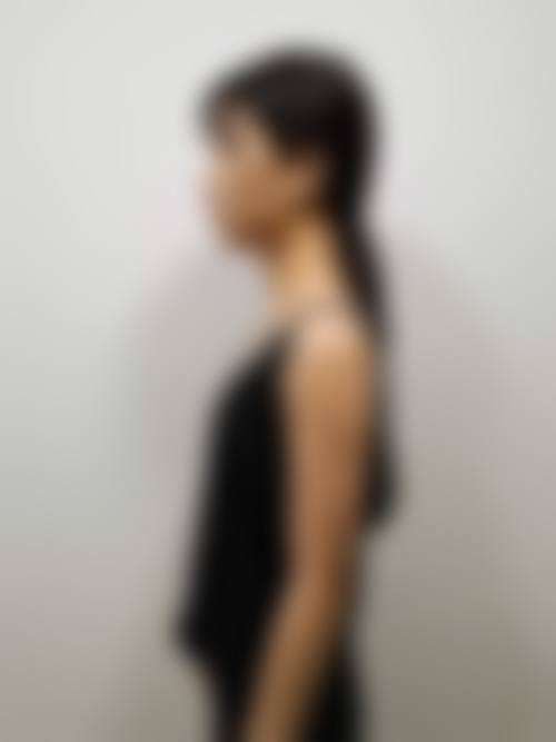 王玉秀医生简介项目优势