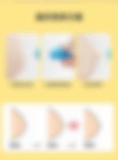 四川大学华 西医院整形科口碑好不好？附真实患者口碑评价