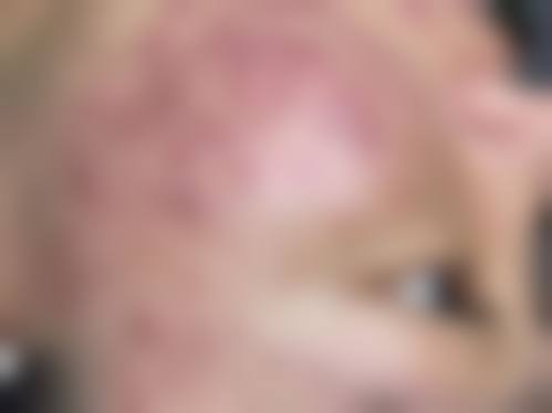 姜娟医生简介口碑如何