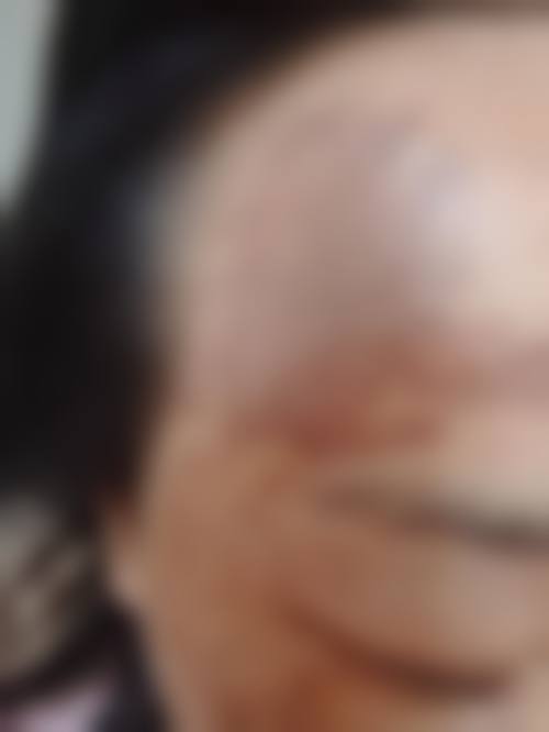 马鞍山福华整形医院项目特色