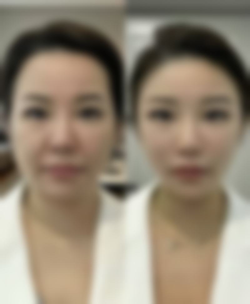 刘宝纯医生项目优势