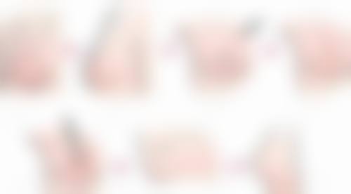 韩国江南延世整形外科医生优势