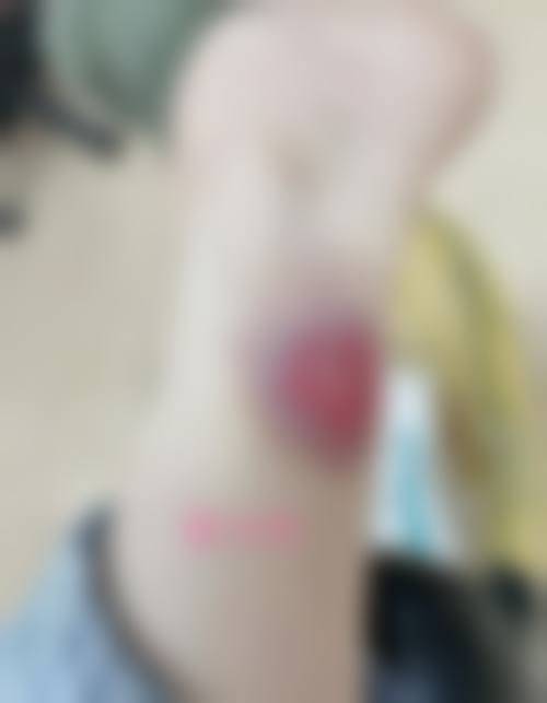 吉林市梁惟苓美容医院价格表