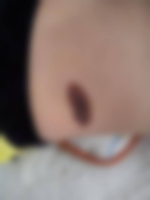 西安伊伊光医疗美容诊所可靠吗