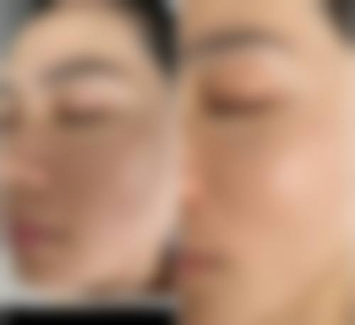 海口壹加壹整形医院怎么样项目特色