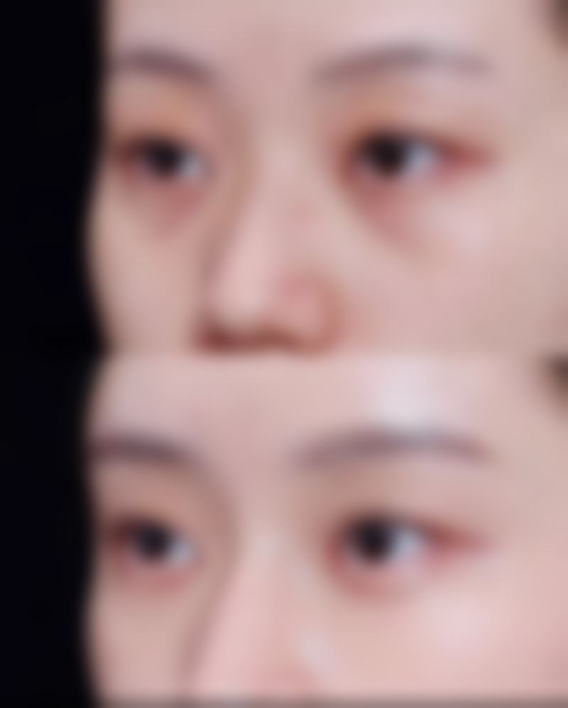 厦门呈美医疗美容诊所价格表