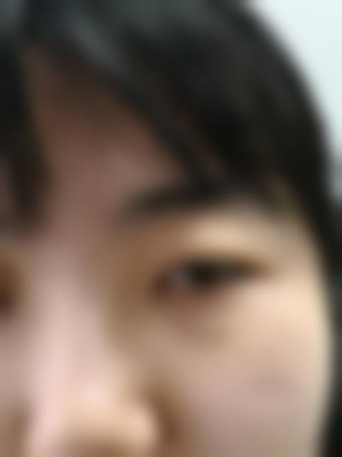 刘玉刚医生简介做手术价格