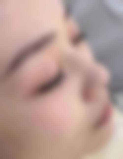 泉州苏蜜如棠医疗美容诊所更擅长什么手术