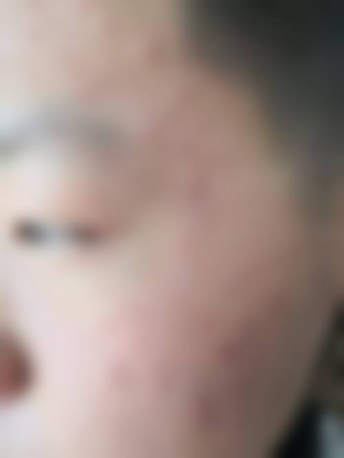 杜曦医生简介做手术价格