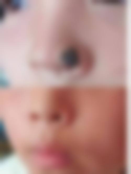 黄晓雯医生做手术价格：因项目而异