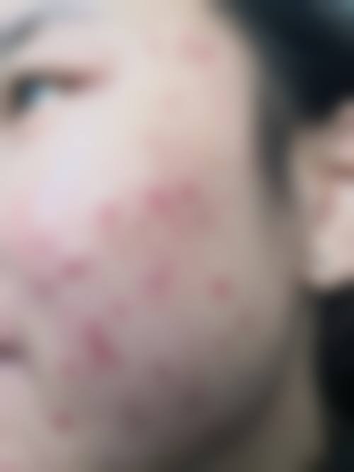 谢晓峰医生简介口碑如何