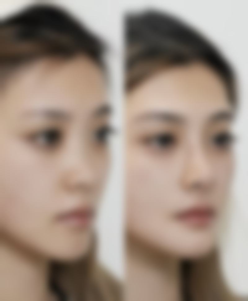 张志强医生简介项目优势