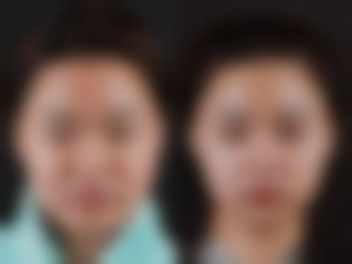 郑萍医生简介项目优势