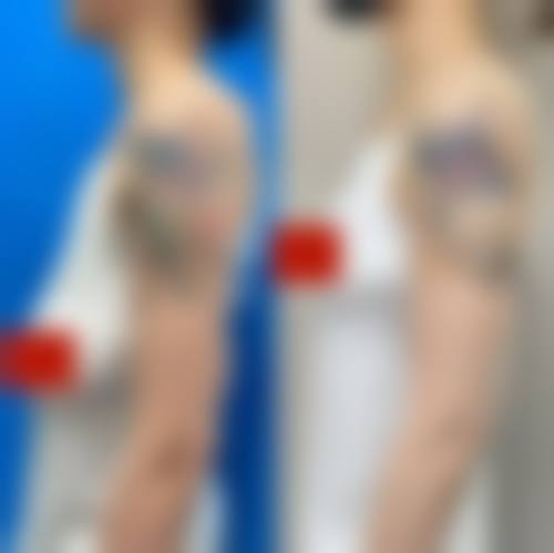 深圳弘美医疗美容特色项目