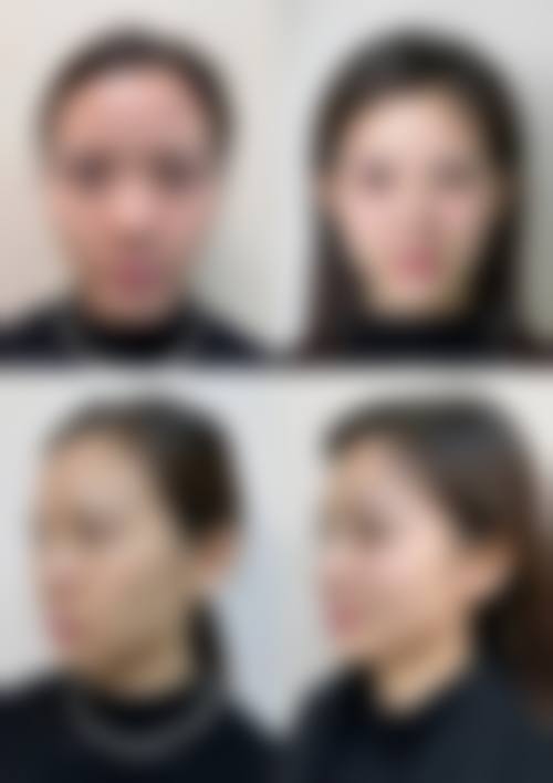 深圳弘美医疗美容口碑情况