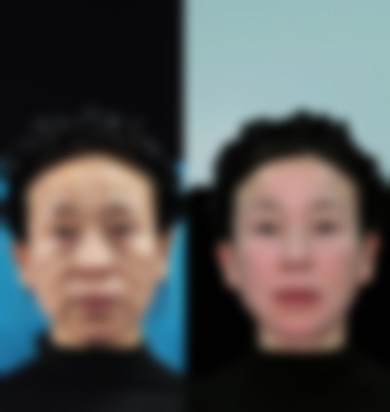北京漾柏净加整形医院项目特色