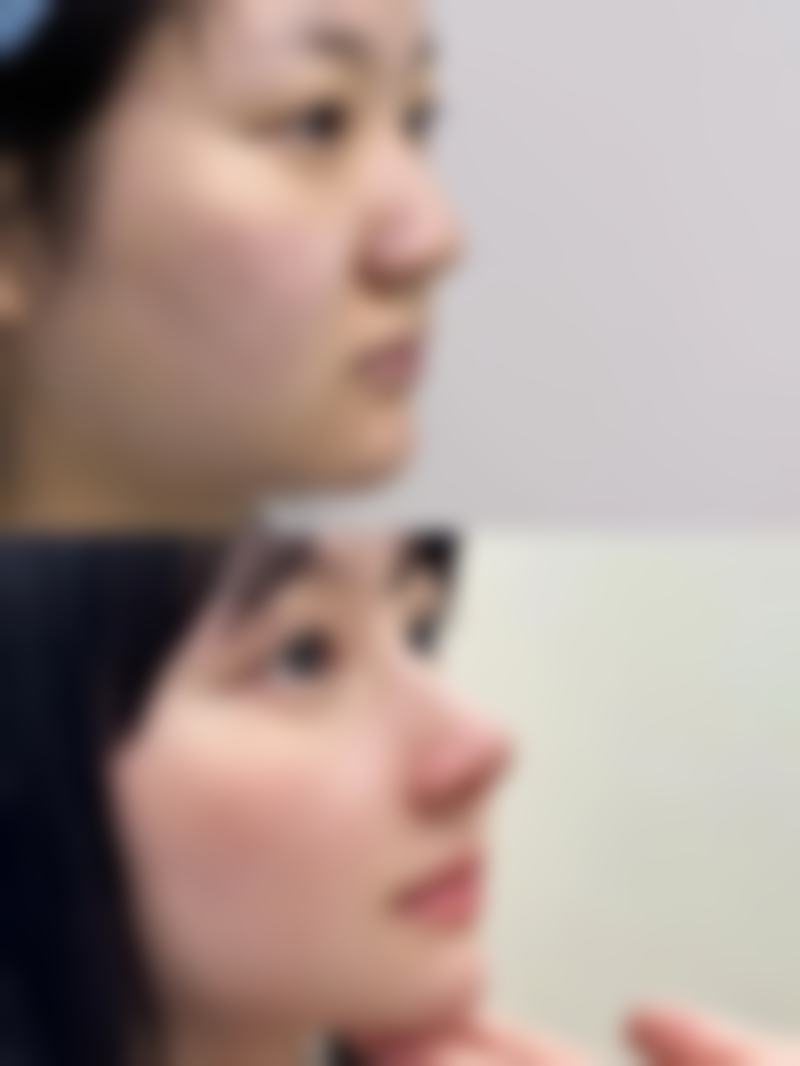 蚌埠优珈医疗美容诊所更擅长什么手术