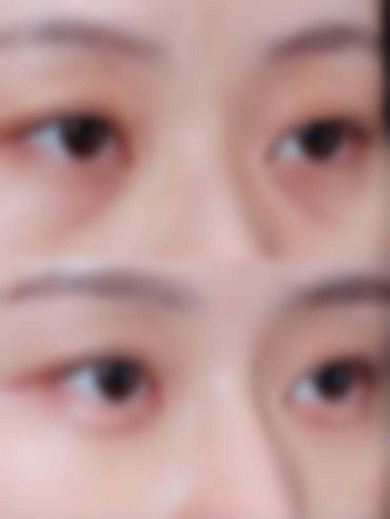 哈尔滨莱尚整形美容门诊部更擅长什么