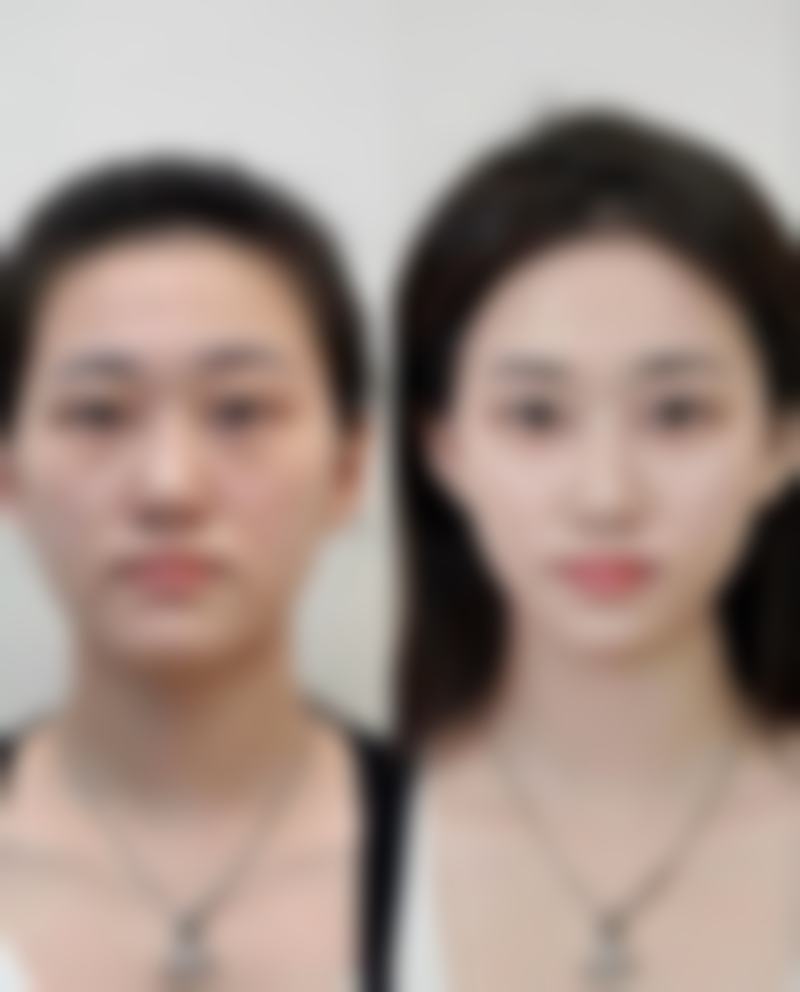 王亚杰医生项目优势
