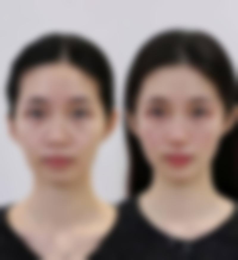 福州隆美尔整形医院价格表