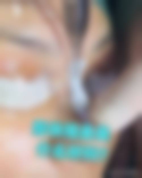 郑州柏丽芙医疗美容抖音团购活动有哪些，价格表
