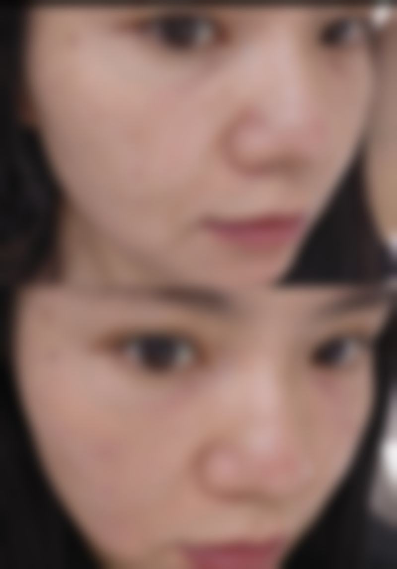 郑泰成医生简介项目优势