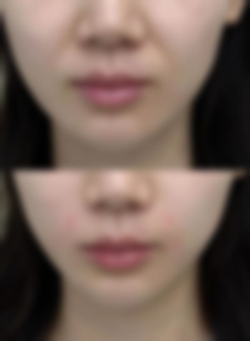 烟台兰积驻颜整形医院怎么样，口碑评价如何？