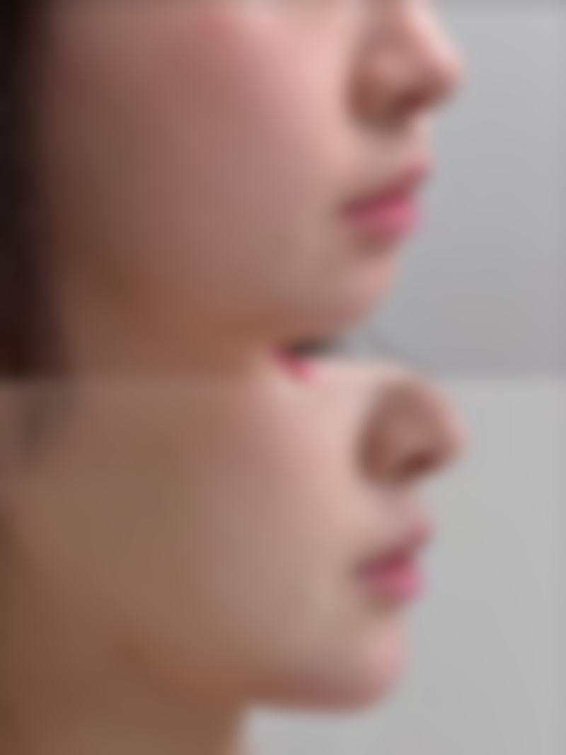 曹珈玮医生简介做手术价格
