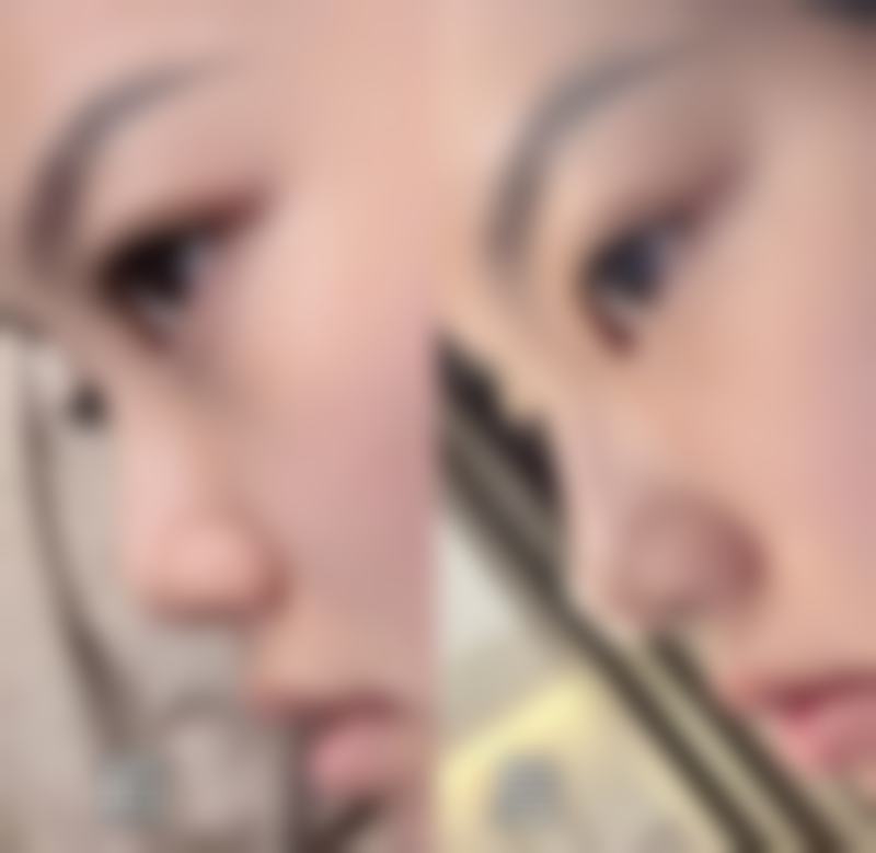 丁琛医生项目优势