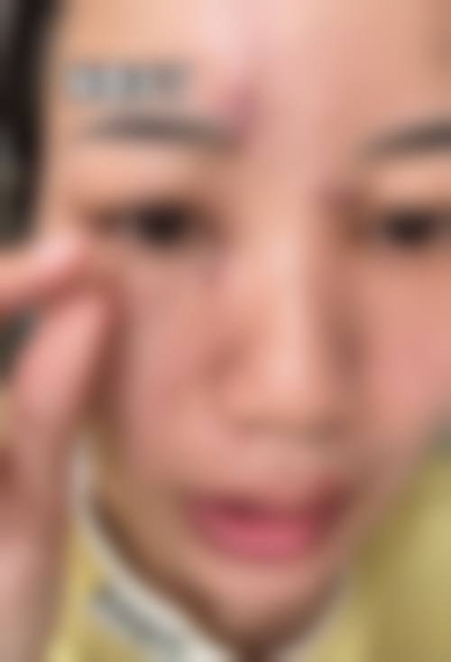 马建华医生简介项目优势
