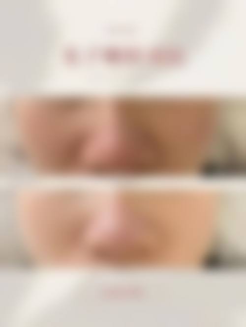 长春尚氏华医医疗美容门诊部顾客实例