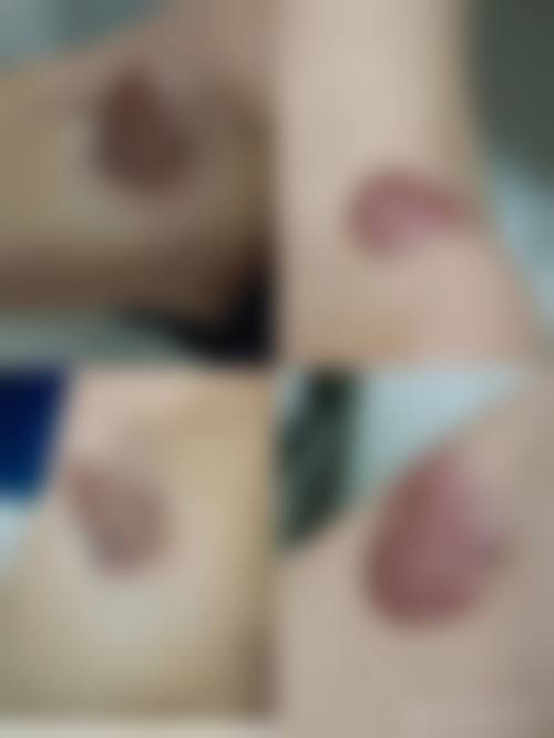 王玉秀医生顾客实例图片