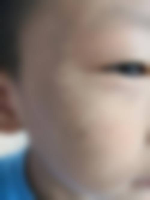 乌鲁木齐苏瑶创美整形诊所更擅长什么手术