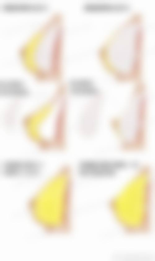 乌鲁木齐苏瑶创美整形诊所价格表