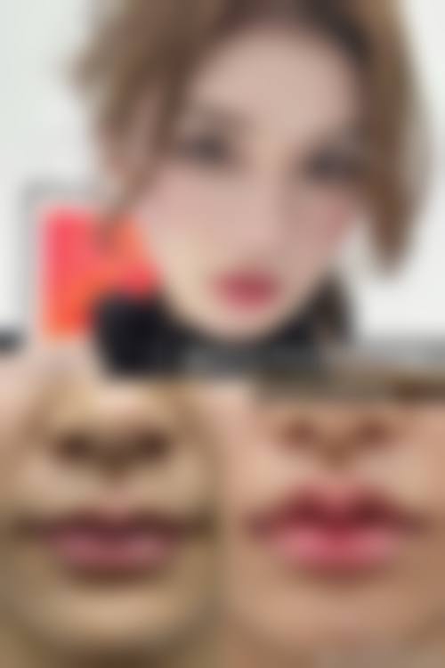 阜新安琪美整形医院口碑好不好