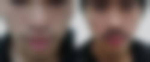 河北大学附属医院整形科怎么样,口碑评价如何?
