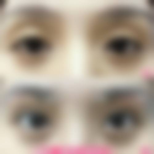 刘蔡钺医生顾客实例图片