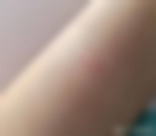 商丘永城河大医疗整形门诊部怎么样