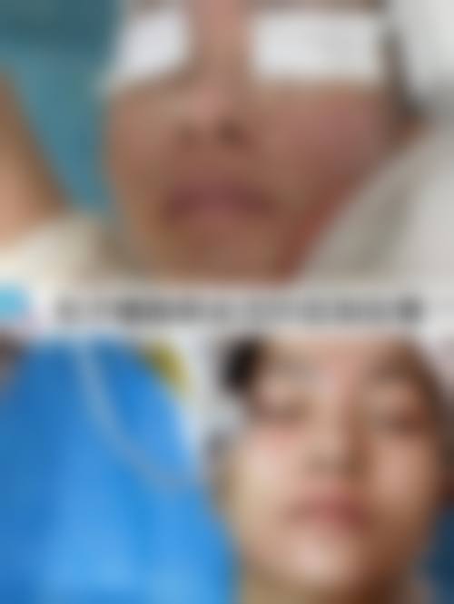 樊佃怀医生口碑如何
