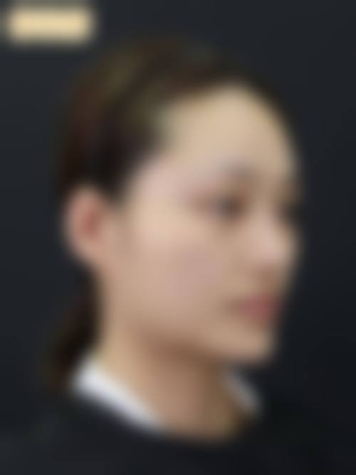 南京轻颜医疗美容诊所更擅长什么手术