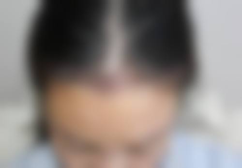 大麦医疗美容植发（上海总院）怎么样？正规吗？