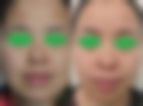 贵阳美尚晟医疗美容的抖音团购活动及价格表