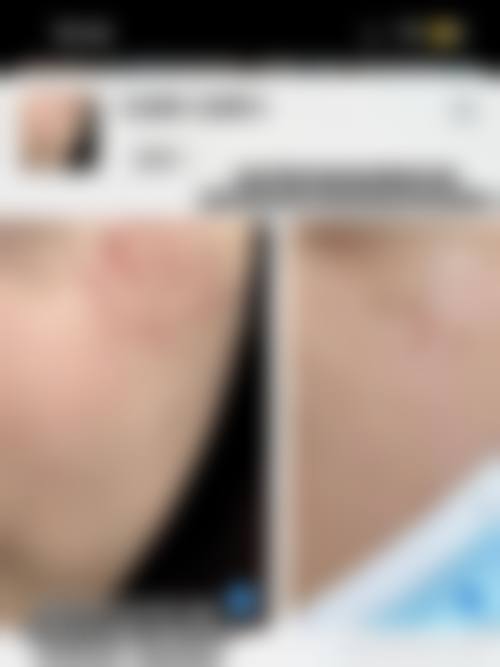 合肥星尚医疗美容正规吗?特色项目有哪些