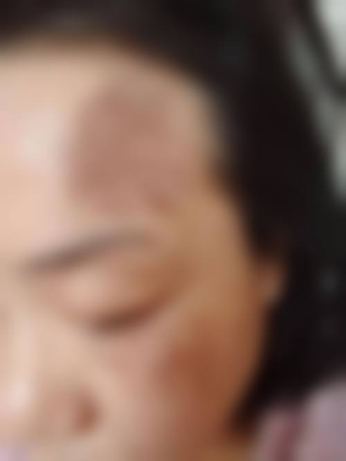韩国菲斯普乐斯Faceplus整形外科怎么样,口碑评价如何?